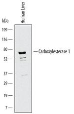 CES1 Antibody in Western Blot (WB)