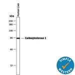 CES1 Antibody in Western Blot (WB)