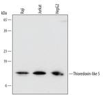 TXNL5 Antibody in Western Blot (WB)