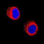 Galectin 10 Antibody in Immunocytochemistry (ICC/IF)