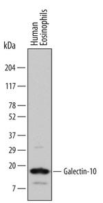 Galectin 10 Antibody in Western Blot (WB)