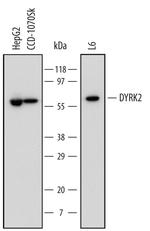 DYRK2 Antibody in Western Blot (WB)