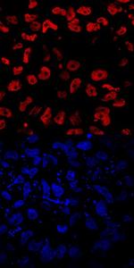 EOMES Antibody in Immunocytochemistry (ICC/IF)