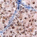 Dot1L Antibody in Immunohistochemistry (Paraffin) (IHC (P))