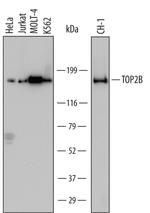 TOP2B Antibody in Western Blot (WB)