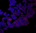 CD155 Antibody in Immunocytochemistry (ICC/IF)