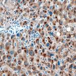 SULT1B1 Antibody in Immunohistochemistry (Paraffin) (IHC (P))