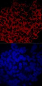 GBA3 Antibody in Immunocytochemistry (ICC/IF)