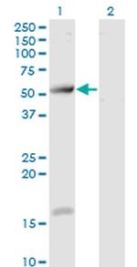 TCP11 Antibody in Western Blot (WB)