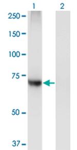 PIGQ Antibody in Western Blot (WB)