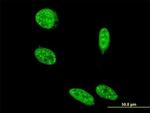 SAP18 Antibody in Immunocytochemistry (ICC/IF)