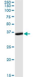 THUMPD1 Antibody in Western Blot (WB)