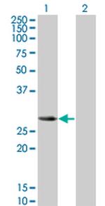 SLA2 Antibody in Western Blot (WB)