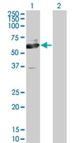 ACCS Antibody in Western Blot (WB)