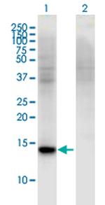RBP7 Antibody in Western Blot (WB)