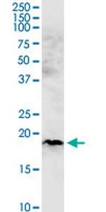 CHCHD4 Antibody in Western Blot (WB)