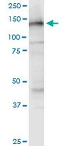 NOMO3 Antibody in Western Blot (WB)
