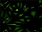 CSAD Antibody in Immunocytochemistry (ICC/IF)