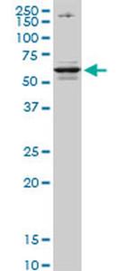 CSAD Antibody in Western Blot (WB)