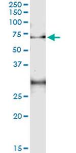 ACD Antibody in Immunoprecipitation (IP)