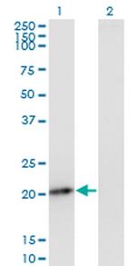 PMVK Antibody in Western Blot (WB)