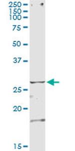 TSSK3 Antibody in Immunoprecipitation (IP)