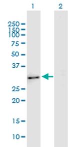 Enkurin Antibody in Western Blot (WB)