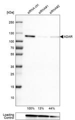 Adenosine Deaminase Antibody