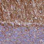 Aquaporin 4 Antibody in Immunohistochemistry (IHC)