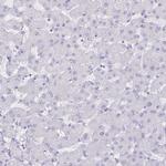 Aquaporin 4 Antibody in Immunohistochemistry (IHC)