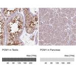 PCM1 Antibody in Immunohistochemistry (IHC)
