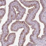 PCM1 Antibody in Immunohistochemistry (IHC)