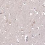 PCM1 Antibody in Immunohistochemistry (IHC)