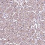 PCM1 Antibody in Immunohistochemistry (IHC)