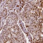 WWTR1 Antibody in Immunohistochemistry (IHC)