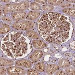 WWTR1 Antibody in Immunohistochemistry (IHC)