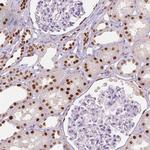 TCF2 Antibody in Immunohistochemistry (IHC)