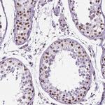 REST Antibody in Immunohistochemistry (IHC)