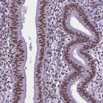 REST Antibody in Immunohistochemistry (IHC)