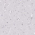 REST Antibody in Immunohistochemistry (IHC)