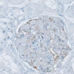 PLA2R1 Antibody in Immunohistochemistry (IHC)