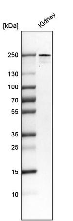 PLA2R1 Antibody in Western Blot (WB)