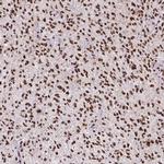 ATRX Antibody in Immunohistochemistry (IHC)