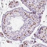 ATRX Antibody in Immunohistochemistry (IHC)