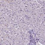 ATRX Antibody in Immunohistochemistry (IHC)