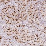 ZNF703 Antibody in Immunohistochemistry (IHC)