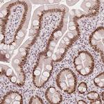 ZNF703 Antibody in Immunohistochemistry (IHC)