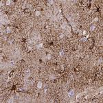 SLC22A2 Antibody in Immunohistochemistry (IHC)