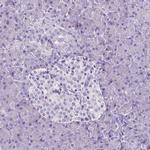 SLC22A2 Antibody in Immunohistochemistry (IHC)