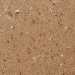 RHOT1 Antibody in Immunohistochemistry (IHC)